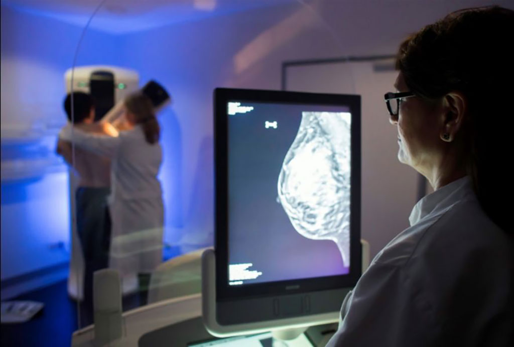 Image: Breast cancer can be detected more often than with standard mammographies (Photo courtesy of University of Münster)