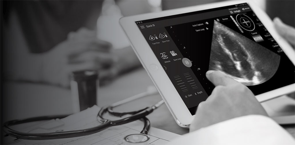 Image: UltraSight is revolutionizing cardiac ultrasound through the power of machine learning (Photo courtesy of UltraSight)