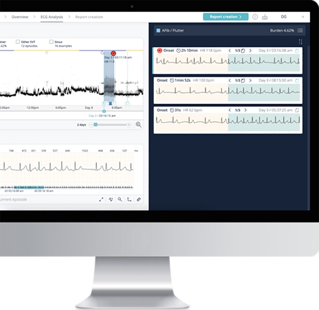 Image: Cardiologs Holter arrhythmia diagnostic software is cloud-based, vendor-neutral and powered by AI (Photo courtesy of Cardiologs)
