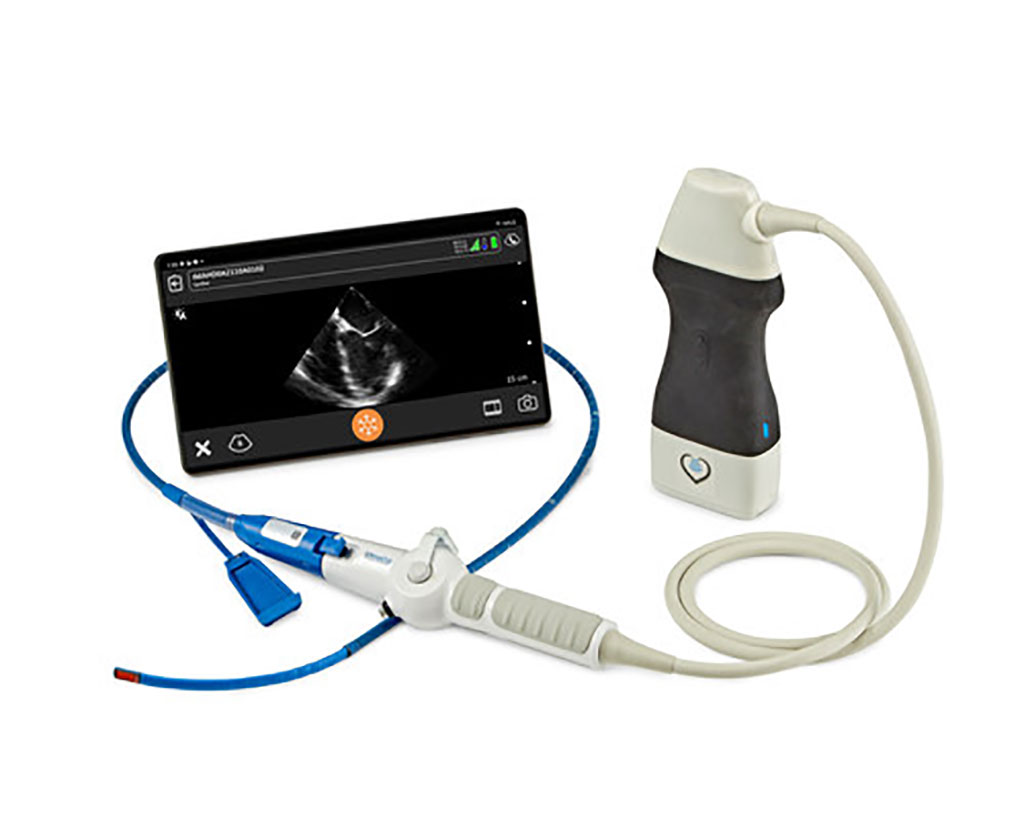 Image: Zura handheld hemodynamic ultrasound system (Photo courtesy of Clarius)