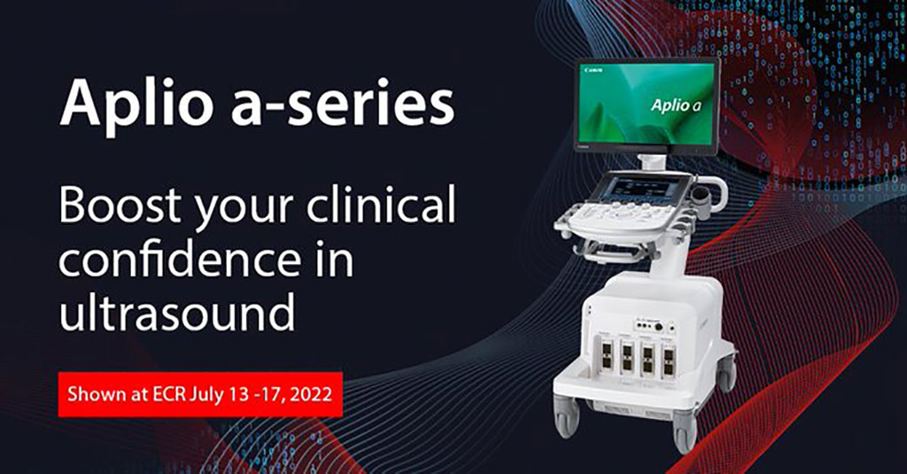 Image: Aplio a-series ultrasound systems were also on display at ECR 2022 (Photo courtesy of Canon Medical)