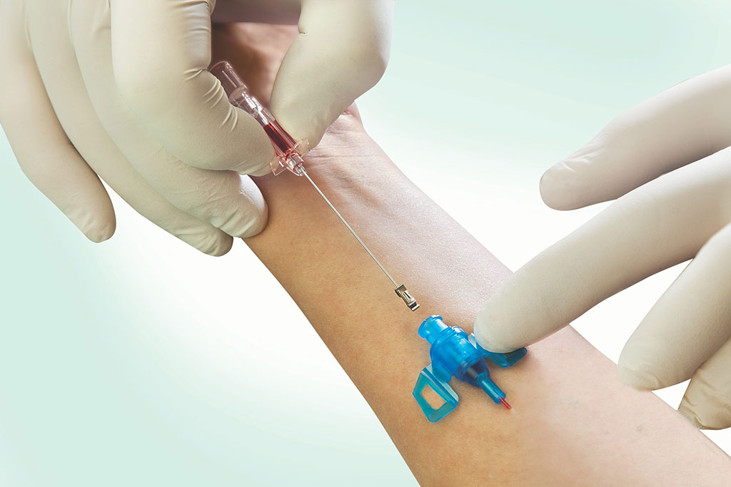 Image: The Introcan Safety 2 IV Catheter reduces risk of needlestick injuries (Photo courtesy of B. Braun)