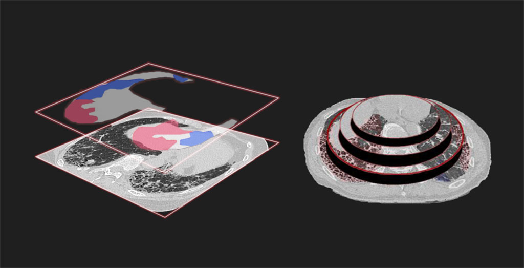 Image: AI performs as well as medical specialists in analyzing lung disease (Photo courtesy of Nagoya University)