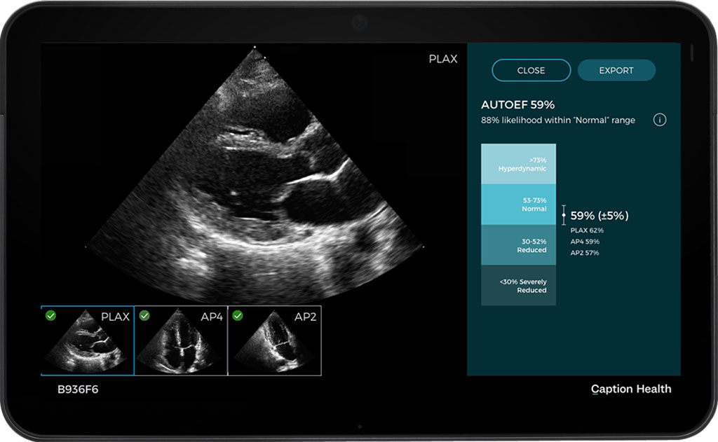 Image: The AI platform scales to a breadth of clinical applications (Photo courtesy of Caption Health)