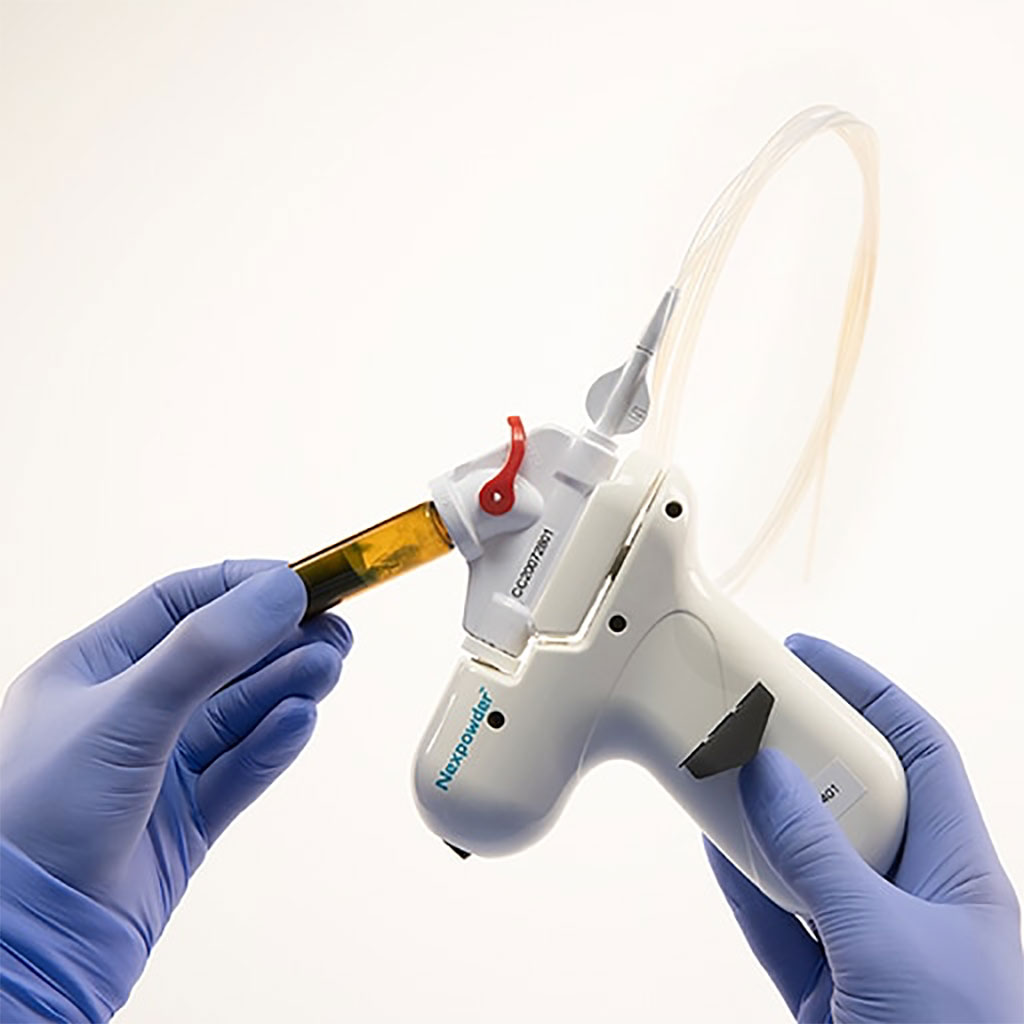 Image: The Nexpowder endoscopic hemostasis system has received U.S. FDA clearance (Photo courtesy of Medtronic)