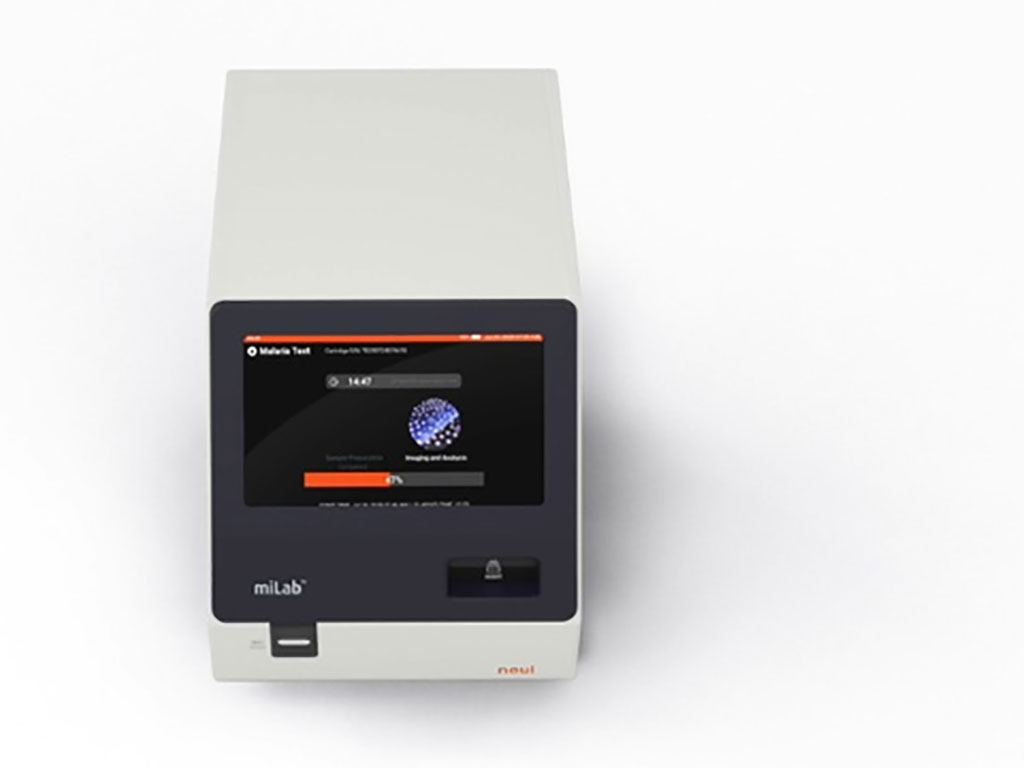 Image: The miLab AI-based electro-dynamic blood diagnostic platform (Photo courtesy of Noul)