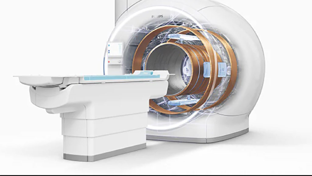 Image: BlueSeal magnet for helium-free MR operations (Photo courtesy of Philips) Image: BlueSeal magnet for helium-free MR operations (Photo courtesy of Philips)