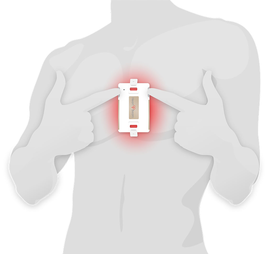 Image: Patented technology allows HeartBeam AIMIGo credit card-sized device to enable a 12-lead ECG anytime, anywhere (Photo courtesy of HeartBeam)