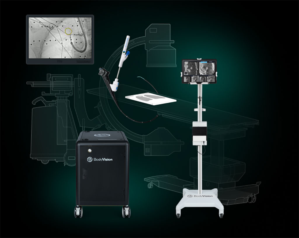 Image: LungVision has been used in 2,000 diagnostic bronchoscopy procedures worldwide (Photo courtesy of Body Vision)