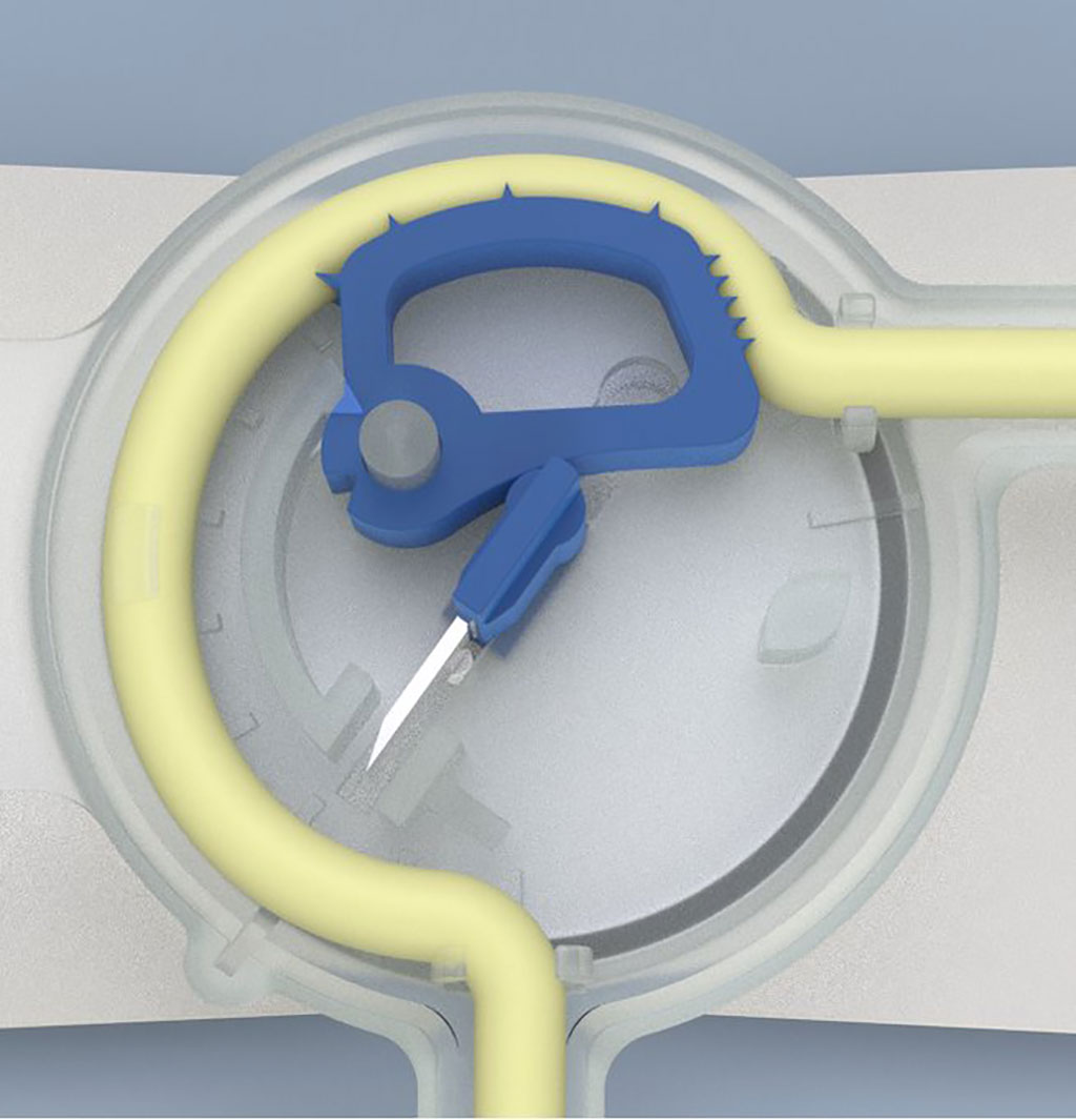 Image: Foley-Safe 2.0 provides an excellent solution to the problem of unintentional movements of the urethral catheter (Photo courtesy of CATHETRIX)