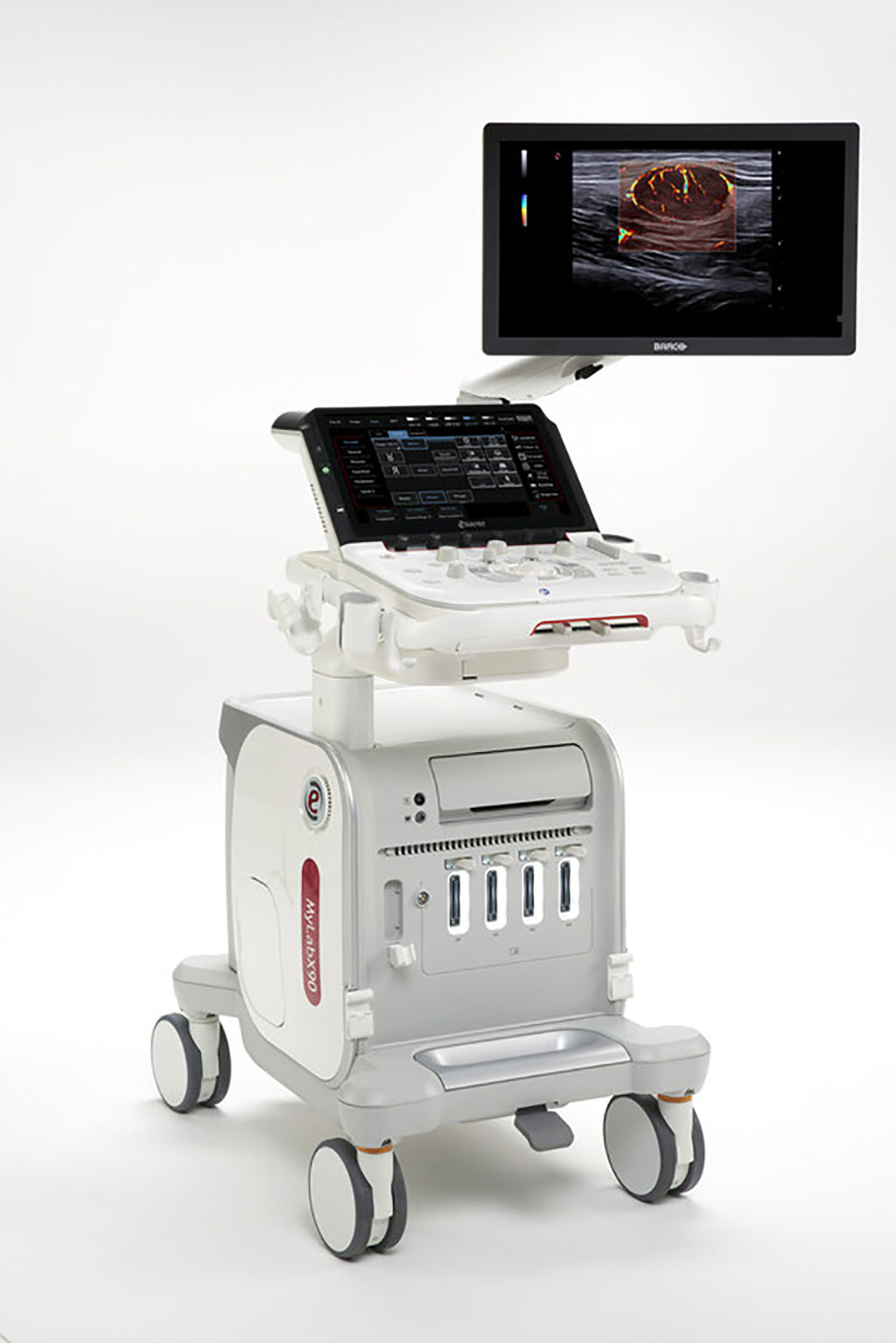 Image: The new MyLab X90 premium ultrasound system showcased at Arab Health 2023 (Photo courtesy of Esaote)