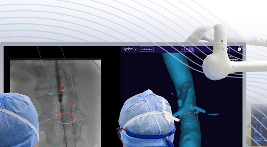 Image: Cydar EV Maps is an integrated cloud solution for planning, navigation and review for endovascular surgeries (Photo courtesy of Cydar)