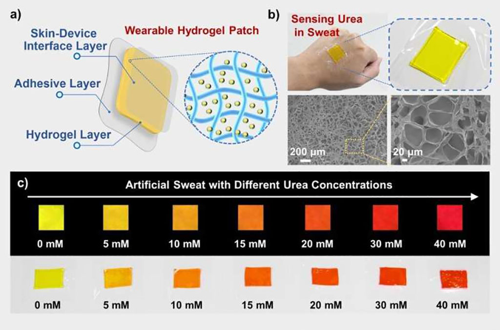 Image: New approach enables faster testing of urea in body fluids (Photo courtesy of HFIPS)