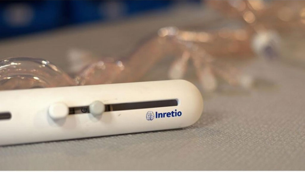 Image: PREVA offers a new approach to clot-retrieving procedures and stroke treatment (Photo courtesy of Inretio)