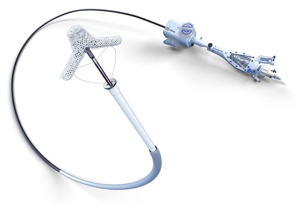Image: The MitraClip system is the leading therapy to treat leaky valves in people with mitral regurgitation (Photo courtesy of Abbott)