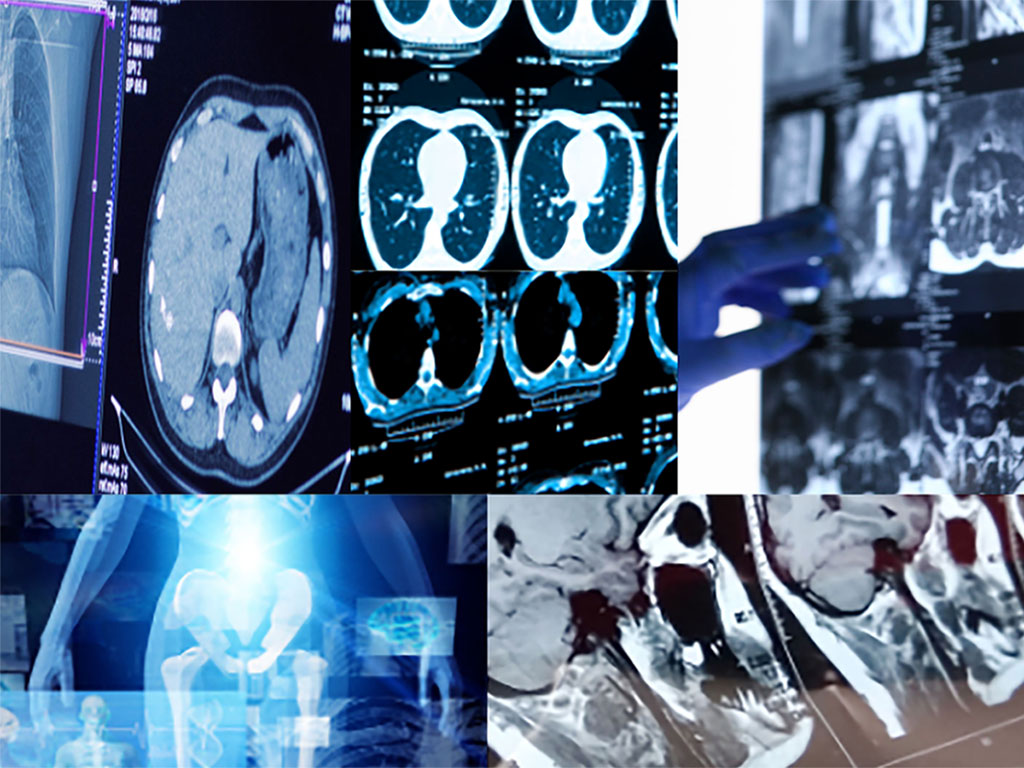 Image: A study has found the use of generative models for augmenting and generating radiological data to be feasible (Photo courtesy of Charité University Berlin) Image: A study has found the use of generative models for augmenting and generating radiological data to be feasible (Photo courtesy of Charité University Berlin)