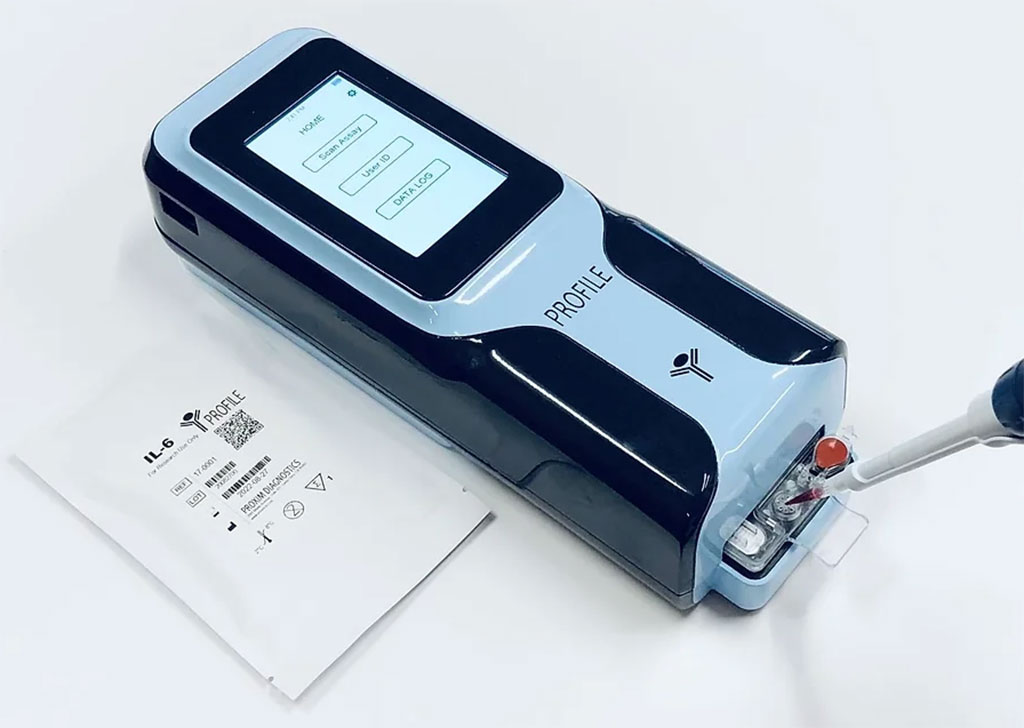 Image: The Profile System is a portable and fully automated immunodiagnostic device (Photo courtesy of Proxim Diagnostics)