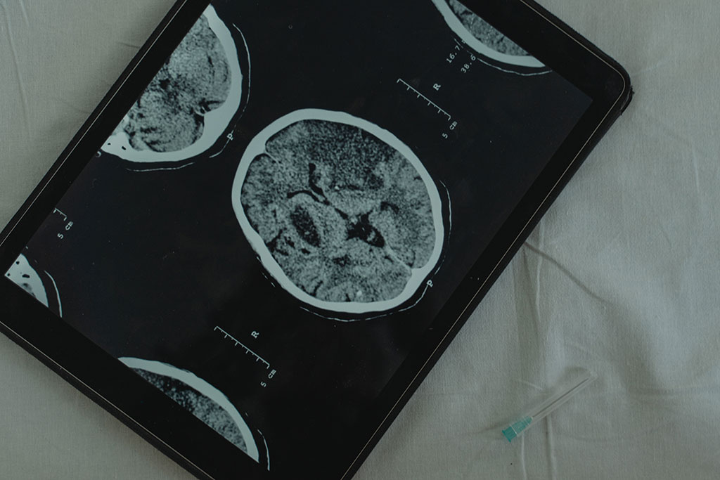 Image: Viz.ai is the first to receive FDA 510(k) clearance for an AI algorithm for abdominal aortic aneurysm (Photo courtesy of Pexels) Image: Viz.ai is the first to receive FDA 510(k) clearance for an AI algorithm for abdominal aortic aneurysm (Photo courtesy of Pexels)