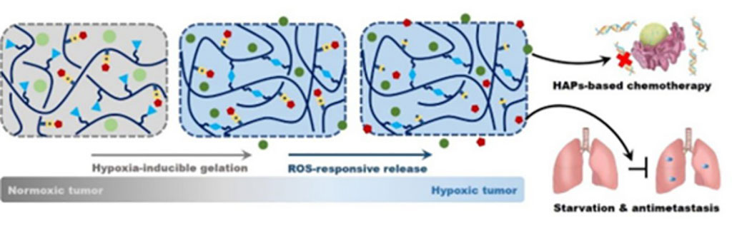 Image: The dual-responsive mechanism of the hydrogels in achieving HAP-based chemotherapy and metastasis inhibition (Photo courtesy of CAS)