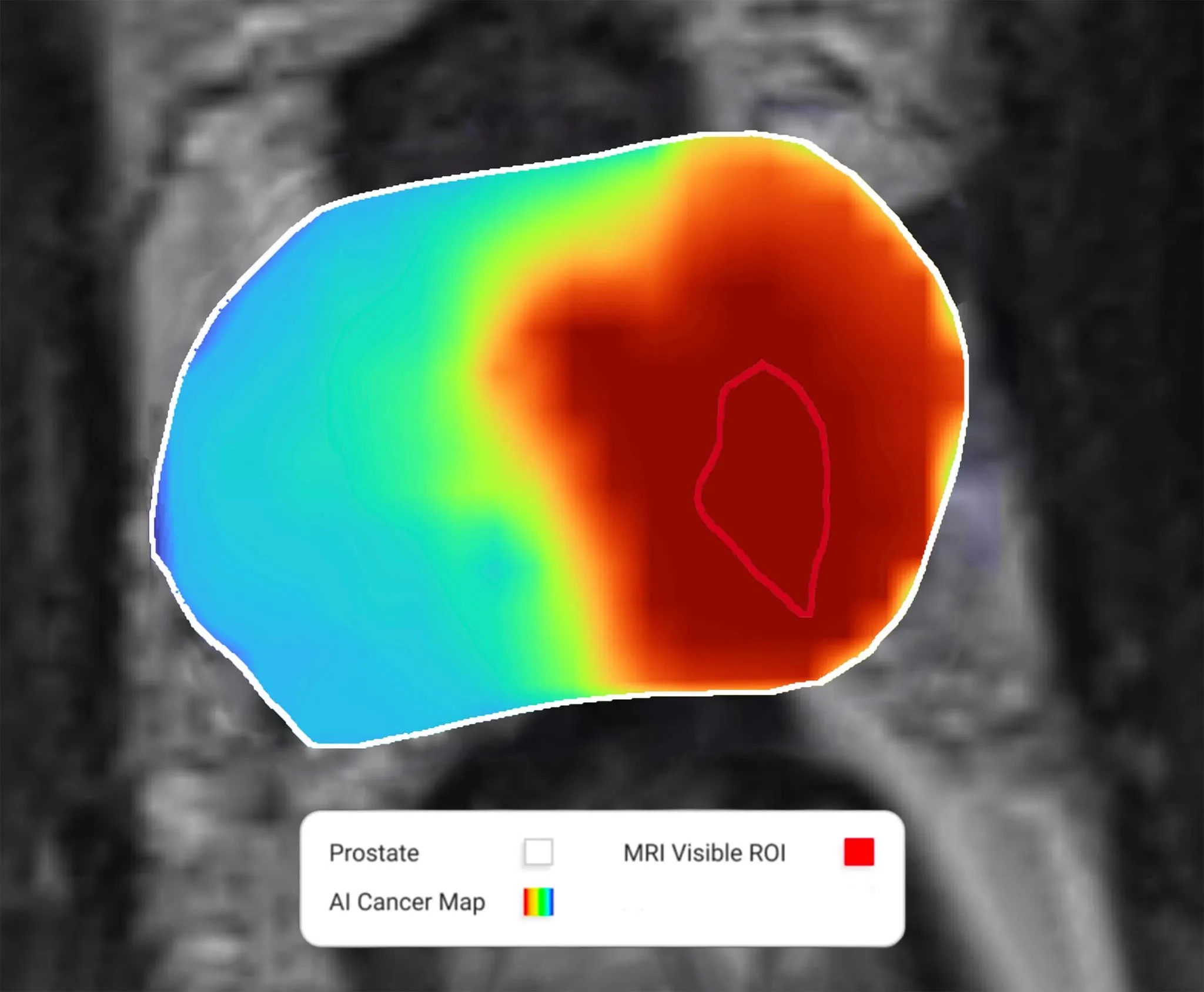 The Unfold AI prostate cancer management platform enables more personalized and precise treatments (Photo courtesy of Avenda Health)