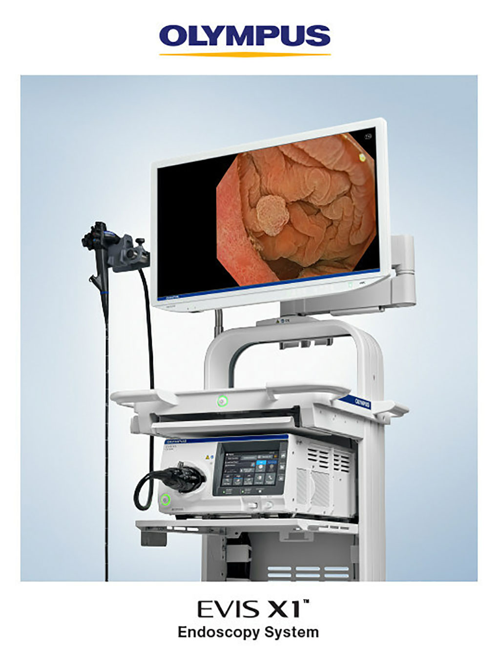 Image: The Olympus EVIS X1 endoscopy system (Photo courtesy of Olympus)