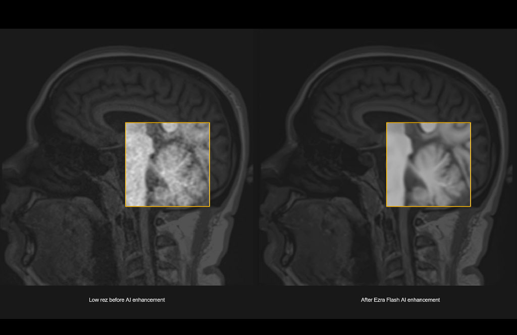 Image: Ezra Flash AI has received 510(k) FDA clearance, enabling roll out of the world’s first 30-minute full body MRI (Photo courtesy of Ezra) Image: Ezra Flash AI has received 510(k) FDA clearance, enabling roll out of the world’s first 30-minute full body MRI (Photo courtesy of Ezra)