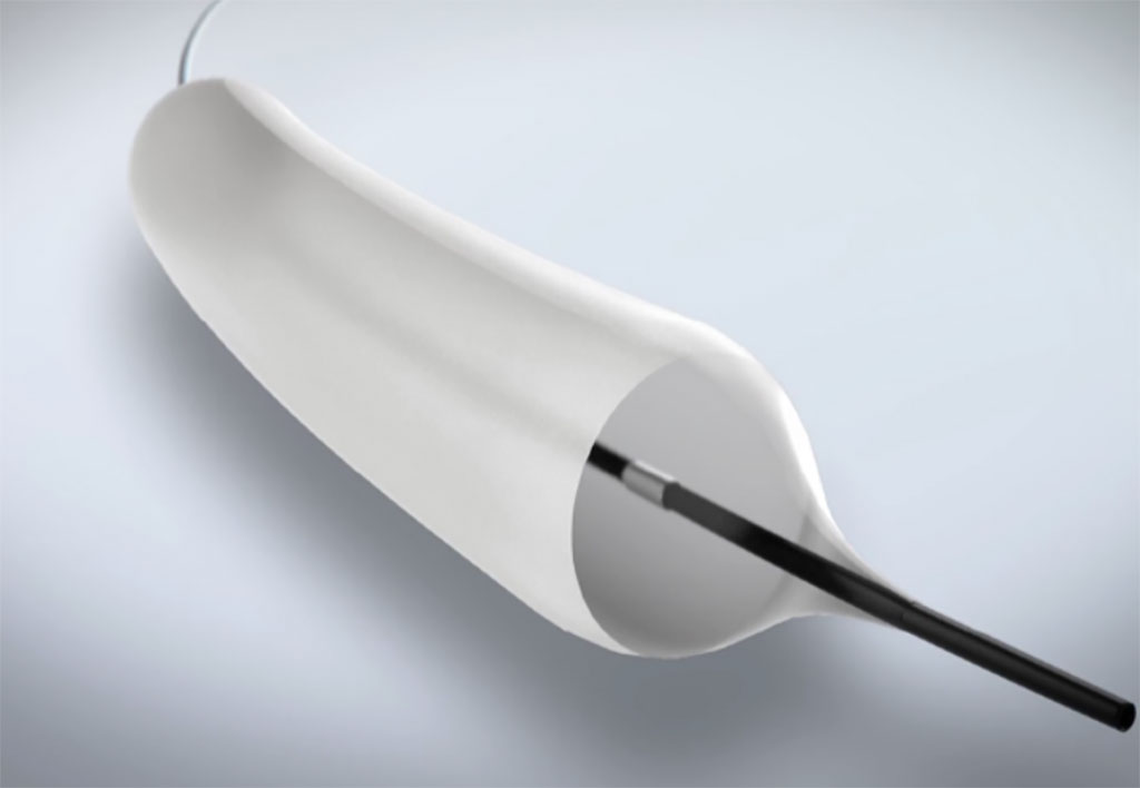 Image: ProTractX3 TTS DCB has been granted US FDA’s breakthrough device designation (Photo courtesy of GIE Medical)