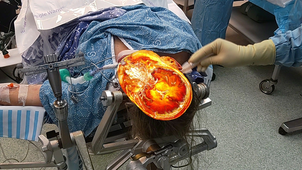 Image: The VisAR augmented reality system is shattering surgical boundaries (Photo courtesy of Novarad)