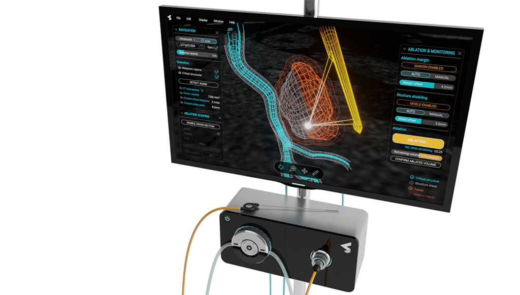 Image: The ‘smart’ needle is being designed to treat cancerous tumors (Photo courtesy of Current Surgical)