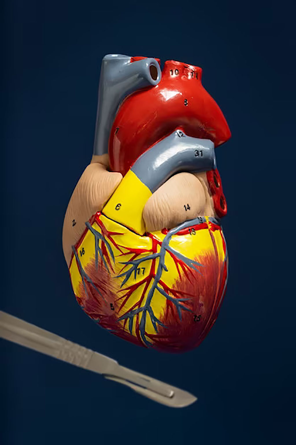 Image: The novel investigational device is designed to relieve pressure in the left side of heart (Photo courtesy of Freepik)