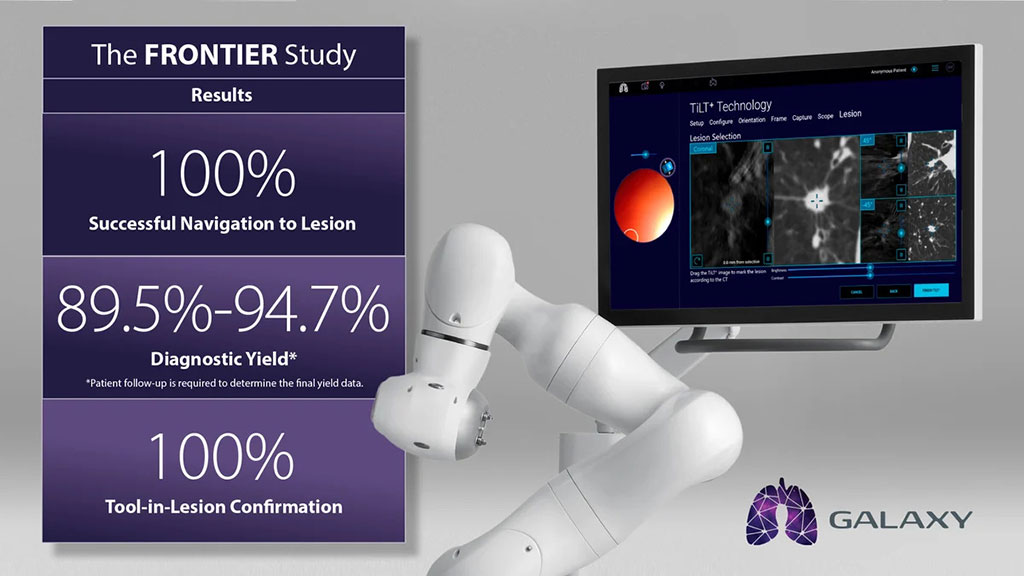 Image: The Galaxy System provides tool-in-lesion confirmation, enabling users to deliver patient-first care (Photo courtesy of Noah Medical)