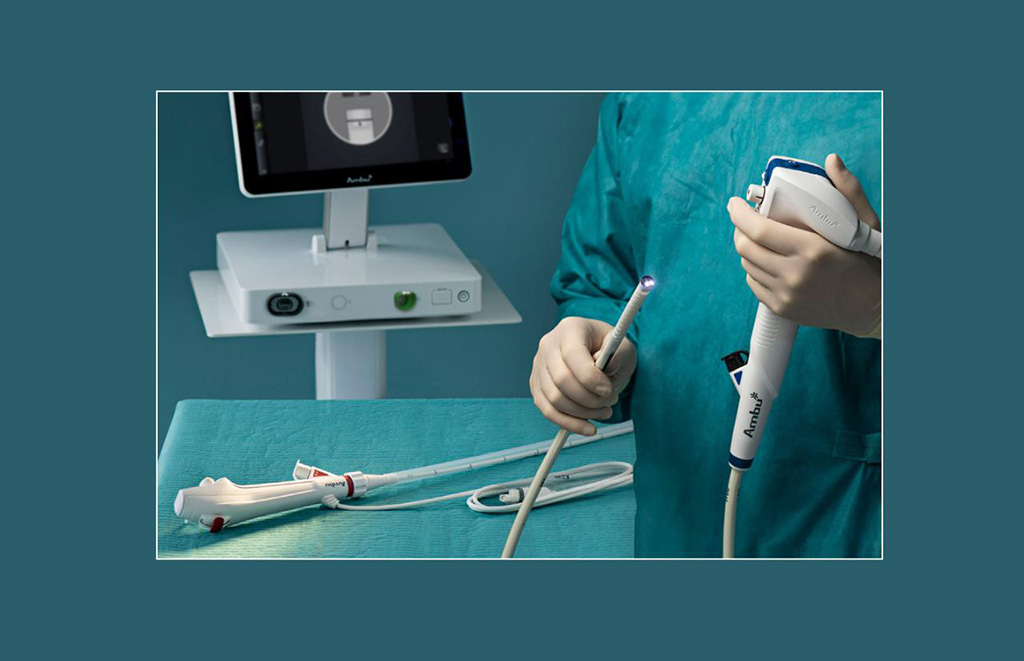 Image: Ambu has received CE mark for its therapeutic gastroscope with a large 4.2mm working channel (Photo courtesy of Ambu)
