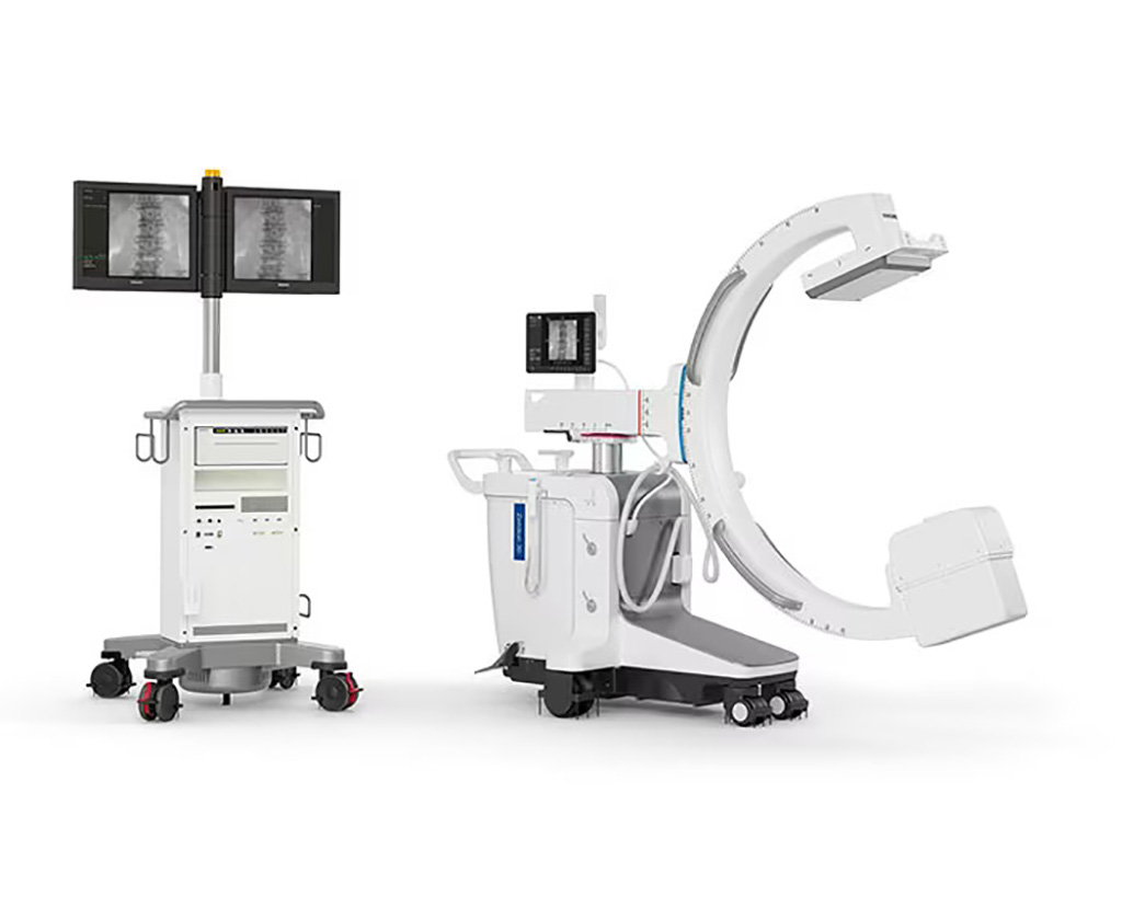 Image: The Zenition 30 mobile C-arm empowers surgeons with greater personalization and control (Photo courtesy of Royal Philips)