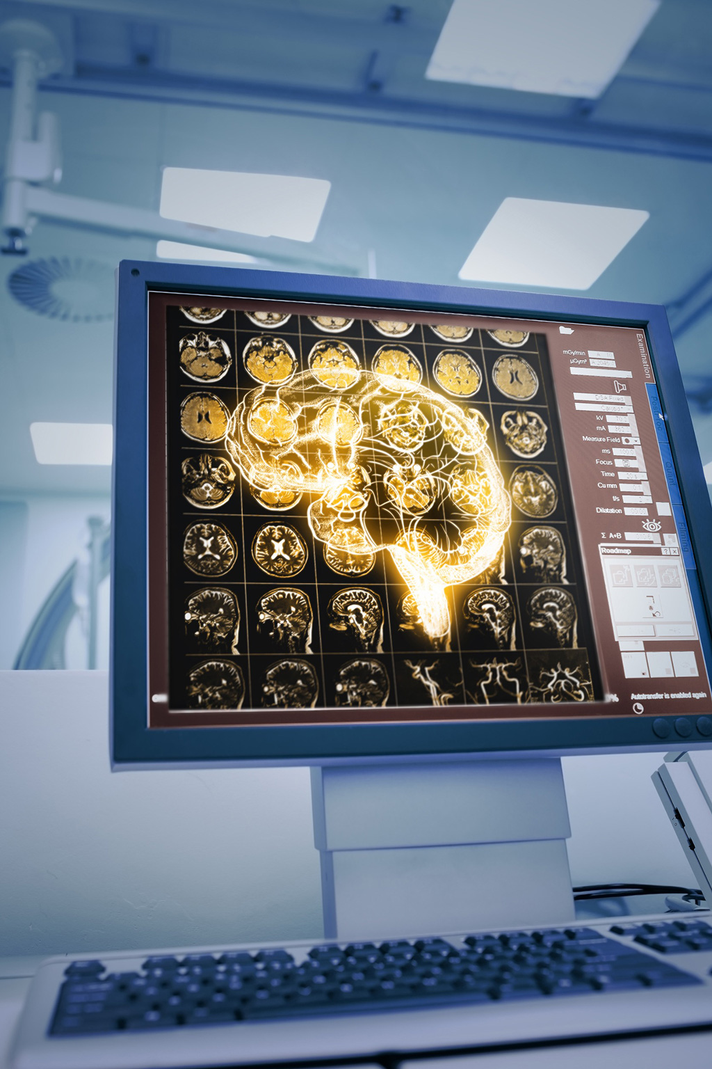 Image: An AI-powered algorithm can help detect unruptured brain aneurysms missed in routine clinical care (Photo courtesy of 123RF) Image: An AI-powered algorithm can help detect unruptured brain aneurysms missed in routine clinical care (Photo courtesy of 123RF)