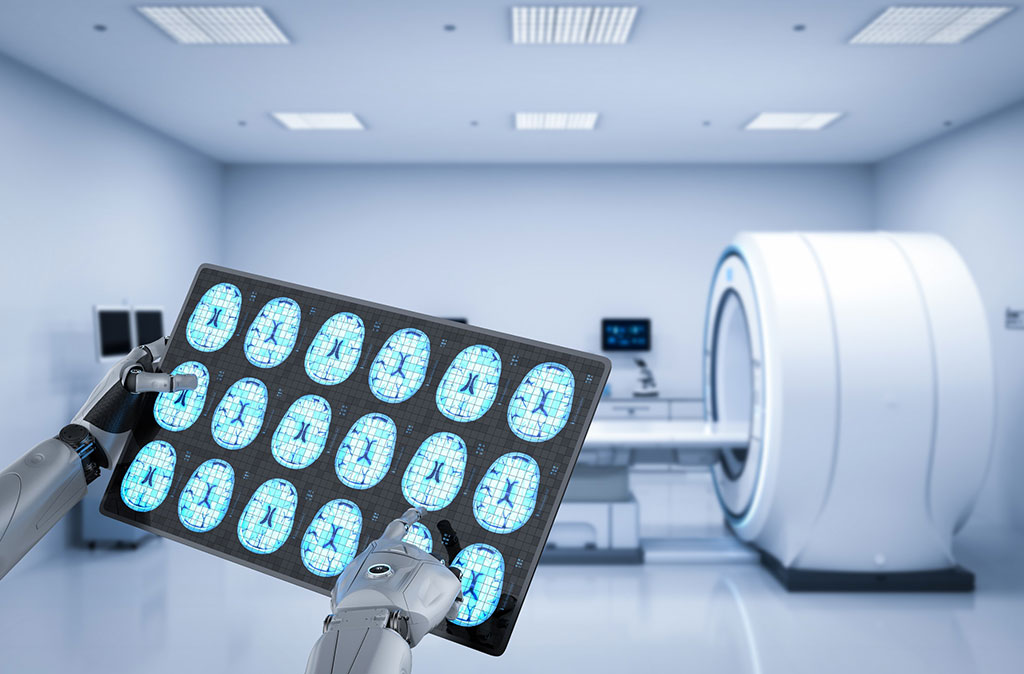 Image: The AI software improves endovascular thrombectomy treatment times for stroke patients (Photo courtesy of 123RF) Image: The AI software improves endovascular thrombectomy treatment times for stroke patients (Photo courtesy of 123RF)