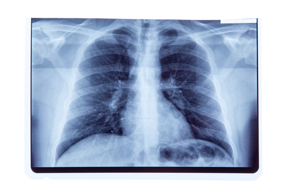 Image: Generative AI can assist in chest radiograph interpretation in the emergency department (Photo courtesy of 123RF) Image: Generative AI can assist in chest radiograph interpretation in the emergency department (Photo courtesy of 123RF)