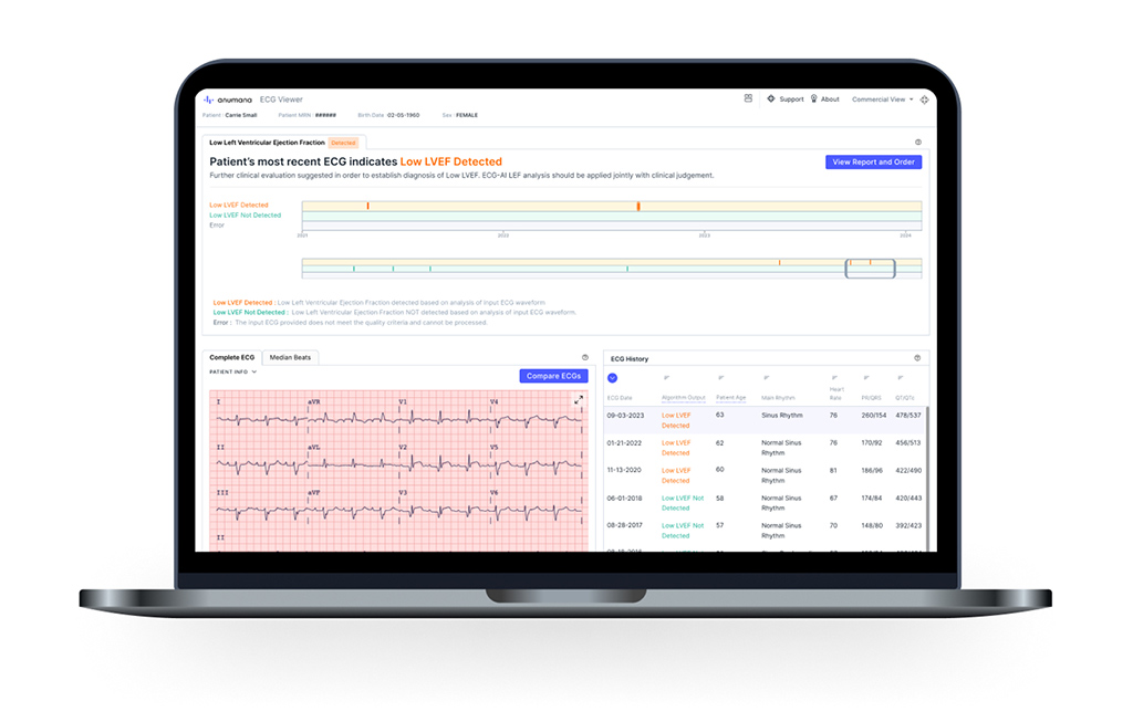 Image: Screen shot of sample data from the ECG-AI LEF software-as-a-medical device (Photo courtesy of Anumana)