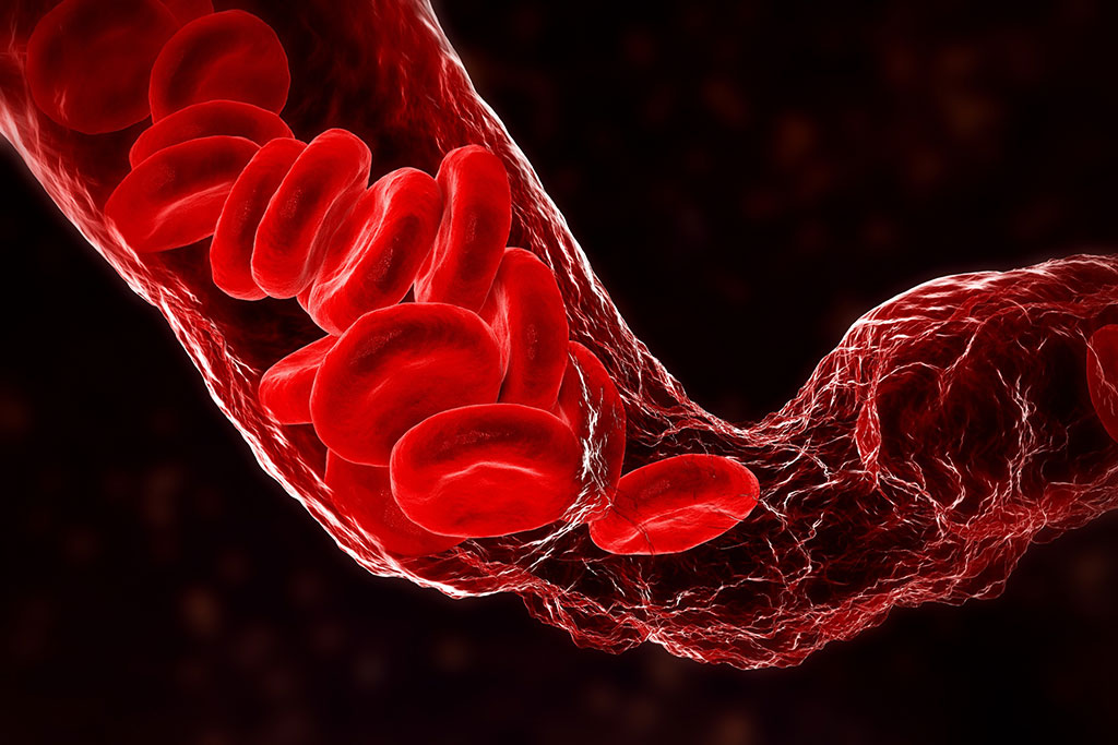 Image: The new AI tool can accurately identify pediatric patients at high risk for blood clots (Photo courtesy of 123RF)