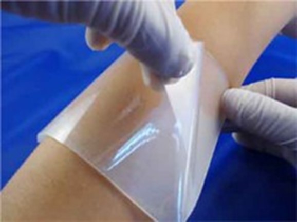 Image: The gelatin patches act as effective tissue adhesives that accelerate wound healing (Photo courtesy of Incheon National University)