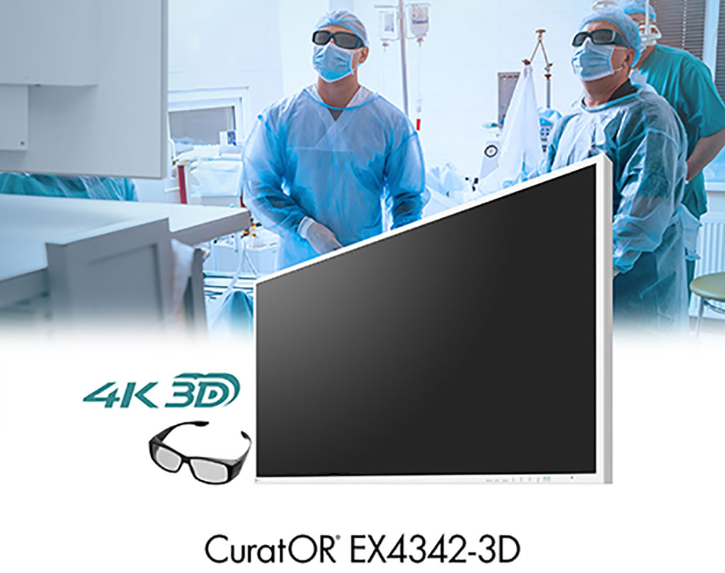 Image: EIZO has released its first large screen 4K UHD monitor with 3D image display for endoscopy and the OR (Photo courtesy of EIZO)
