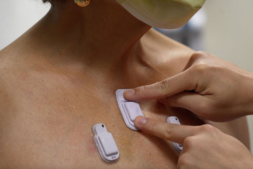 Image: The first-of-their-kind wearables were tested on a range of patients, from premature babies to the elderly (Photo courtesy of Northwestern University)