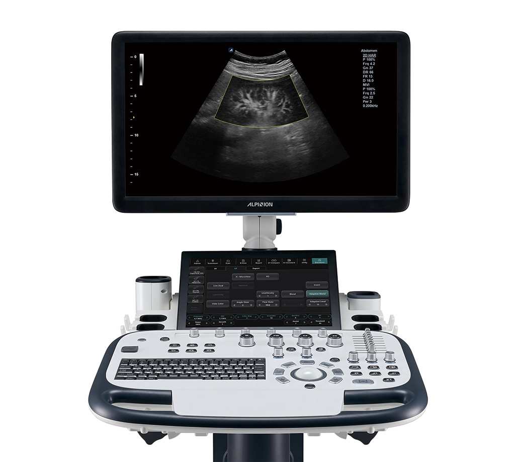 Image: The X-CUBE 90 and X-CUBE 70 with Elite are being showcased at RSNA 2023 (Photo courtesy of ALPINION)