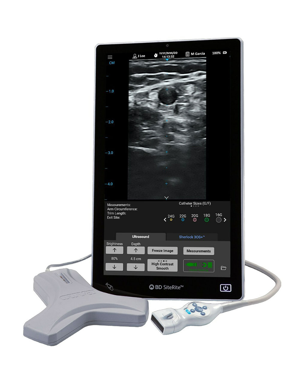 Image: The SiteRite 9 ultrasound system aids in first aid attempt IV insertion success (Photo courtesy of BD)