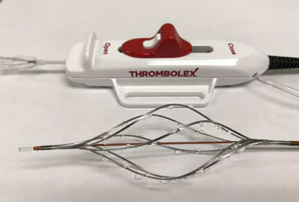 Image: The BASHIR Endovascular Catheter was recently approved by the U.S. FDA (Photo courtesy of THROMBOLEX)