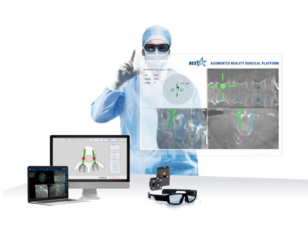 Image: The NextAR AR-assisted navigation system may be feasible and safe in clinical use (Photo courtesy of Medacta International)