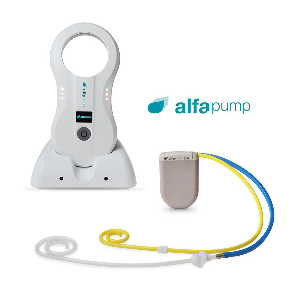 Image: Pending FDA approval, alfapump could become the first active implantable medical device in the US for treating liver ascites (Photo courtesy of Sequana Medical)