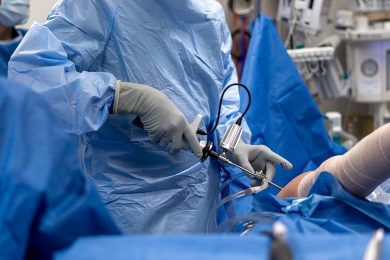 Image: The ArthroFree wireless camera allows surgeons to operate with optimal dexterity and surgical ergonomics (Photo courtesy of Lazurite)