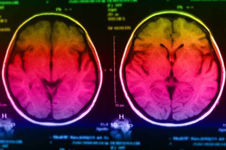 Image: Researchers have created a new MRI brain extraction tool for neonates (Photo courtesy of 123RF) Image: Researchers have created a new MRI brain extraction tool for neonates (Photo courtesy of 123RF)