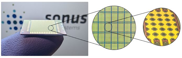 Image: Remote ultrasound technology promises to revolutionize diagnostic imaging (Photo courtesy of Sonus Microsystems)