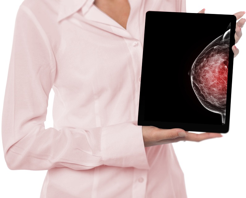 Image: The use of abbreviated MRI in high-risk breast screening has been gaining momentum (Photo courtesy of 123RF) Image: The use of abbreviated MRI in high-risk breast screening has been gaining momentum (Photo courtesy of 123RF)